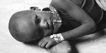 Cholera patient in South Sudan [Photo: courtesy]